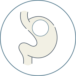 Gastric balloon diagram — Global Obesity Group