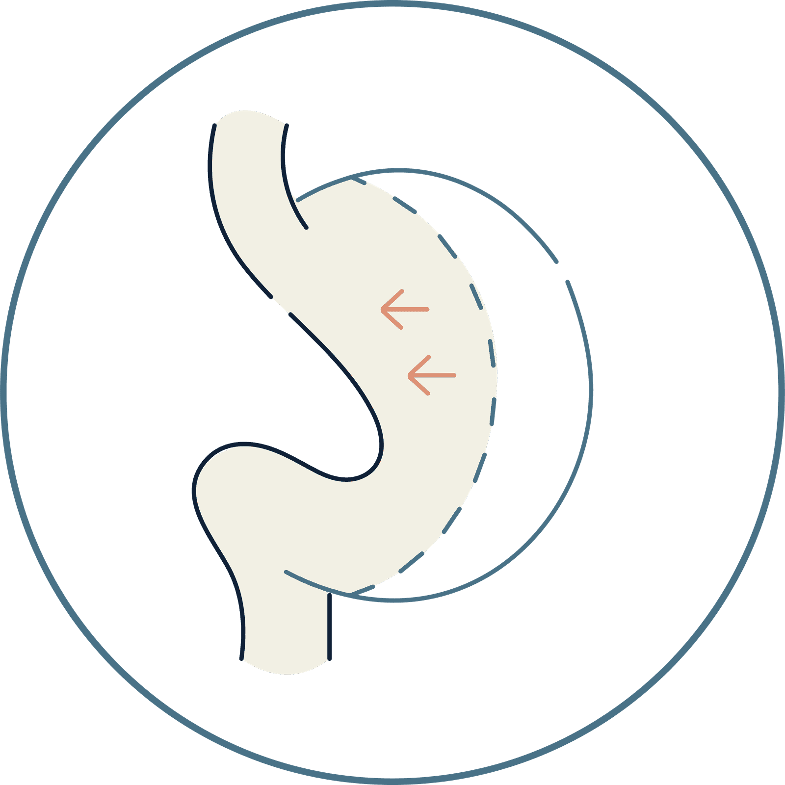 Sleeve gastrectomy anatomy diagram