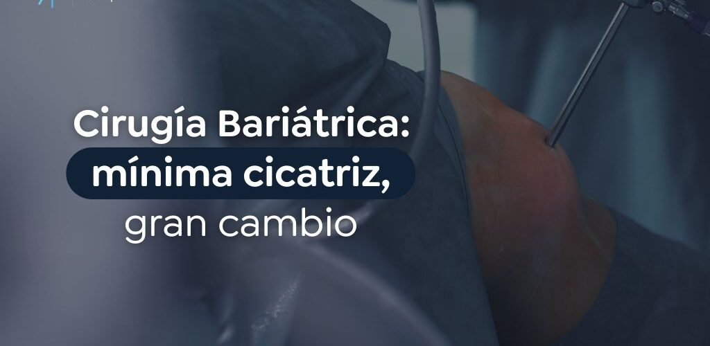 Cirugía bariátrica, cicatriz mínima transforma tu vida hoy