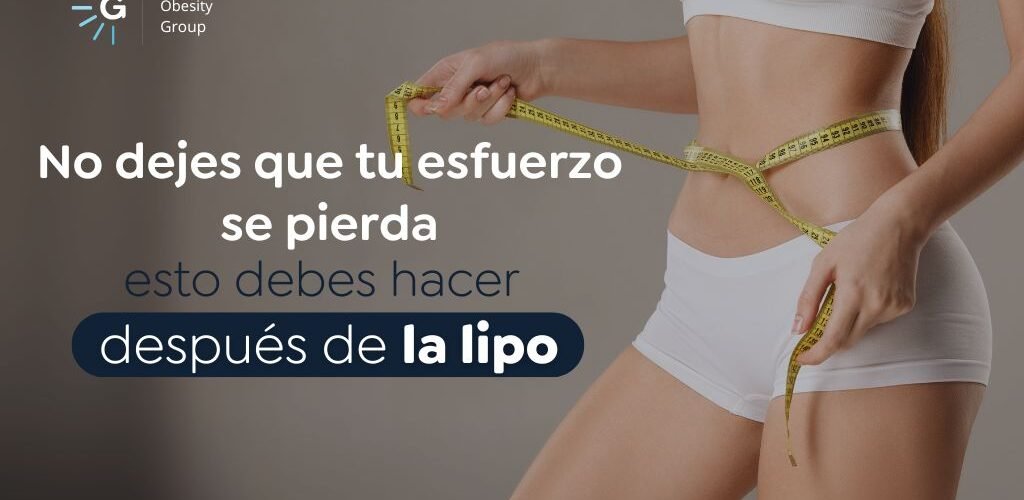 Cómo mantener los resultados de una lipo - Global Obesity Group (2)