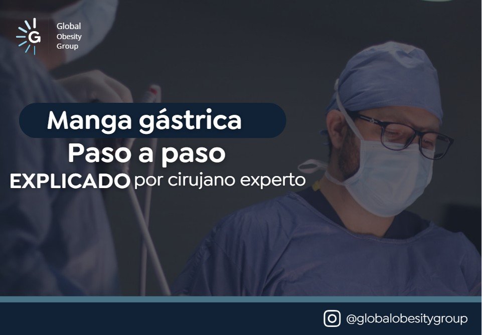 Paso a paso de una manga gástrica- Dr. Felipe Bernal-Global Obesity Group