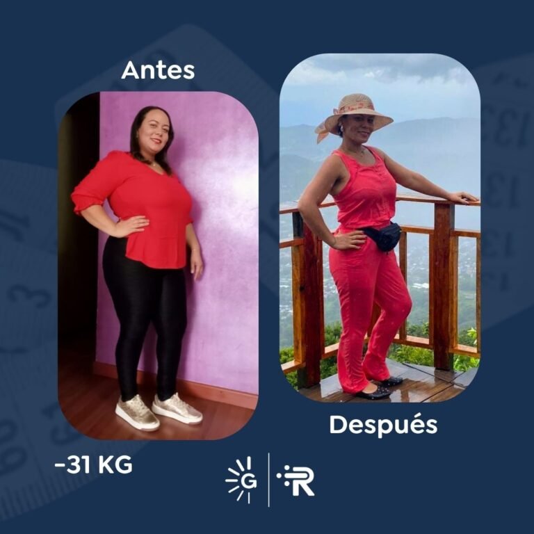Antes y después de cirugía bariátrica en Bogotá con el Dr. Rubén Luna - Global Obesity Group 011025 2