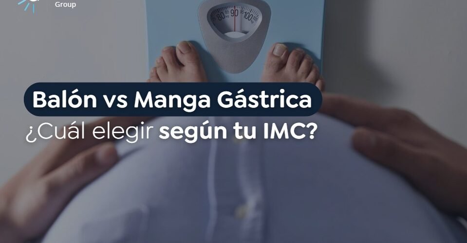 Balón vs Manga gástrica ¿cuál elegir?-Global Obesity Group