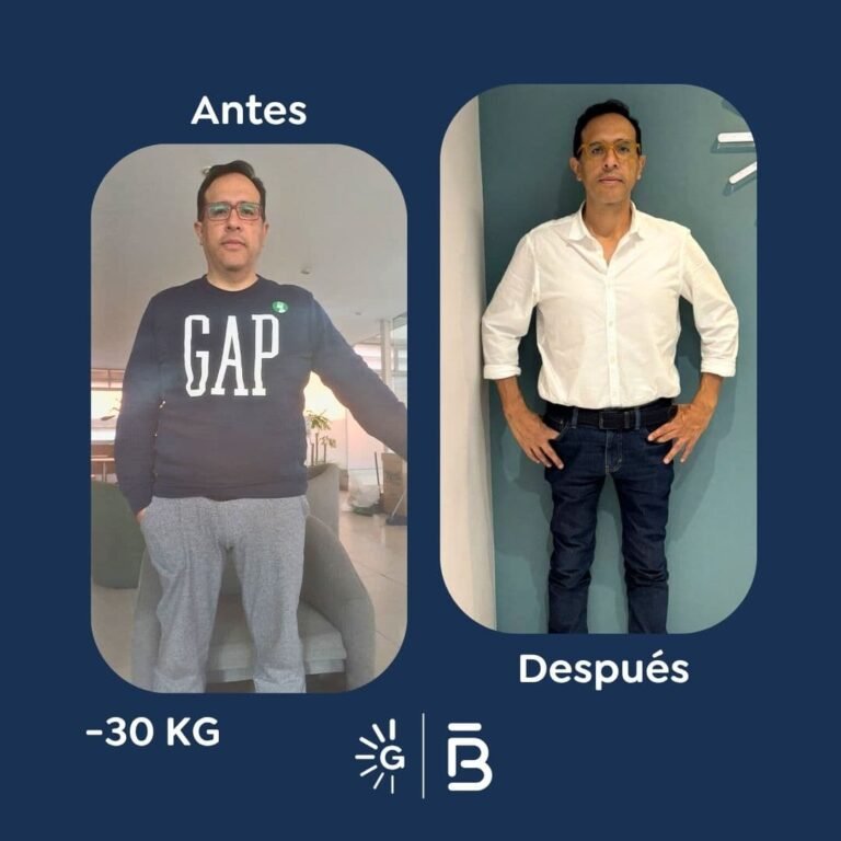 Antes y después de cirugía bariátrica en Bogotá con el Dr. Felipe Bernal - Global Obesity Group 041125