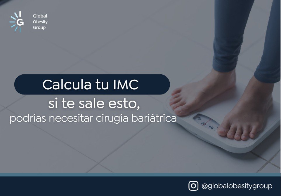 Calcula tu IMC-Global Obesity Group