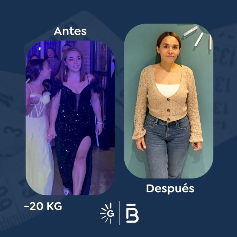 Antes y después de cirugía bariátrica en Bogotá con el Dr. Felipe Bernal - Global Obesity Group 011225 3