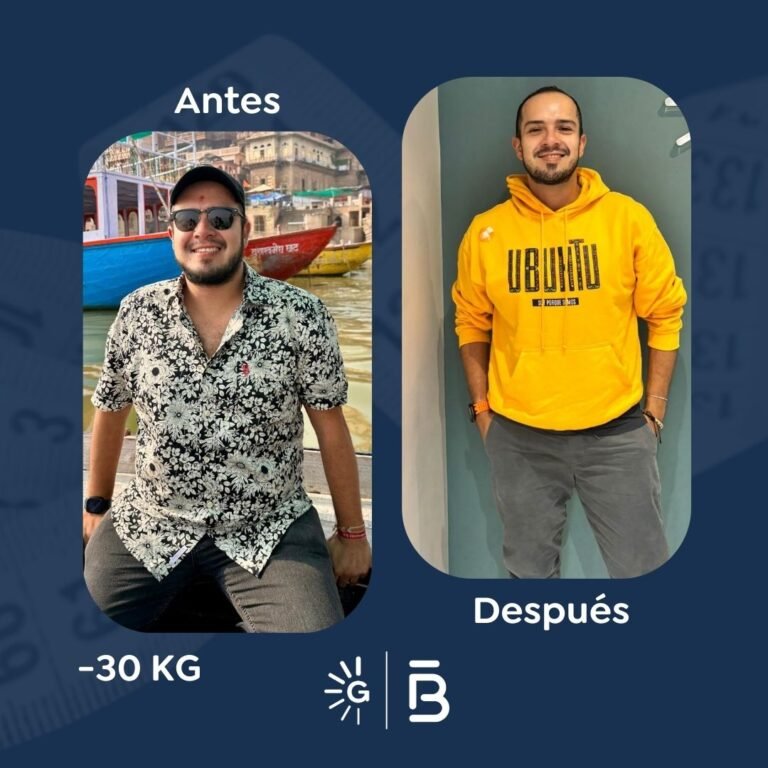 Antes y después de cirugía bariátrica en Bogotá con el Dr. Felipe Bernal - Global Obesity Group 011225 4