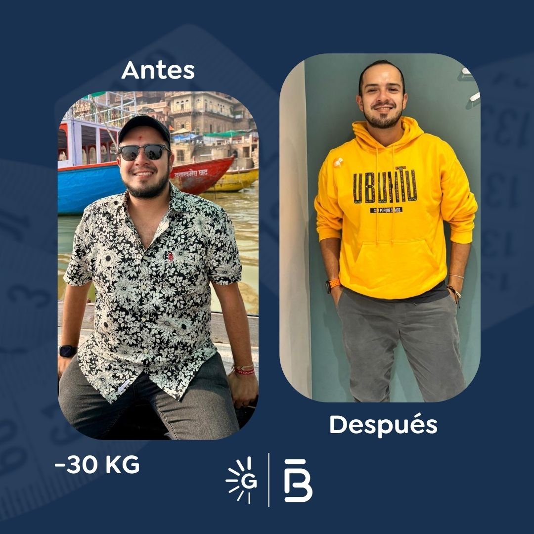Antes y después de cirugía bariátrica en Bogotá con el Dr. Felipe Bernal - Global Obesity Group 011225 4
