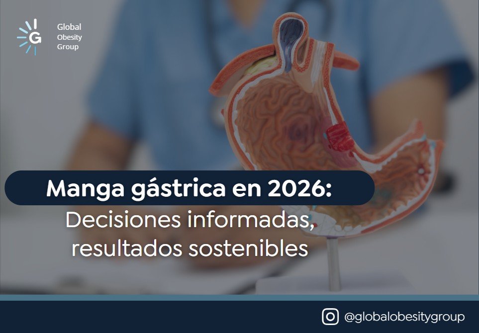 Manga Gástrica en 2026- Global Obesity Group