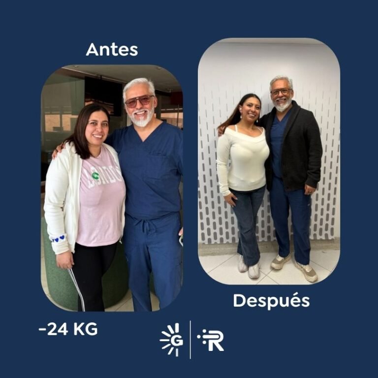 Antes y después de cirugía bariátrica en Bogotá con el Dr. Felipe Bernal - Global Obesity Group 011225