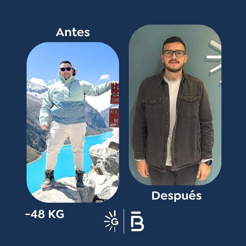 Antes y después de cirugía bariátrica en Bogotá con el Dr. Felipe Bernal - Global Obesity Group 011225 2