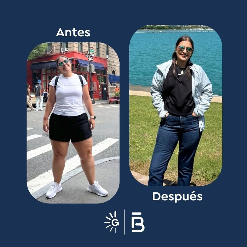 Antes y después de cirugía bariátrica en Bogotá con el Dr. Felipe Bernal - Global Obesity Group 011225 2