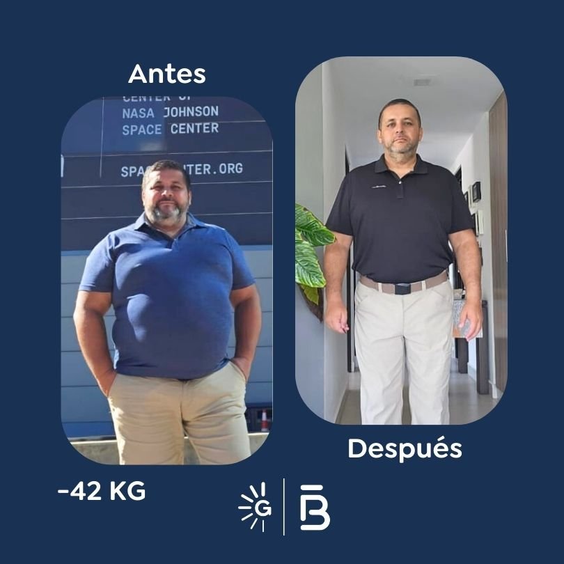 Antes y después de cirugía bariátrica en Bogotá con el Dr. Felipe Bernal - Global Obesity Group 011225 2