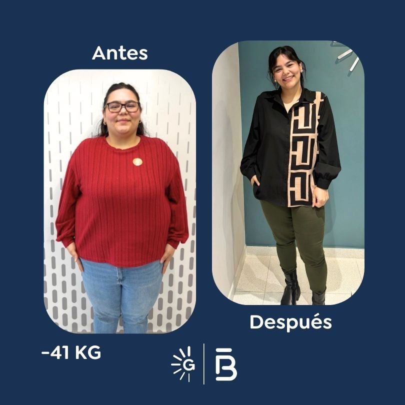 Antes y después de cirugía bariátrica en Bogotá con el Dr. Felipe Bernal - Global Obesity Group 011225 2