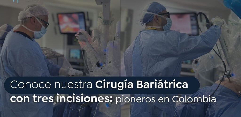 Cirugía Bariátrica con tres incisiones - GLOBAL OBESITY GROUP Bogotá Colombia