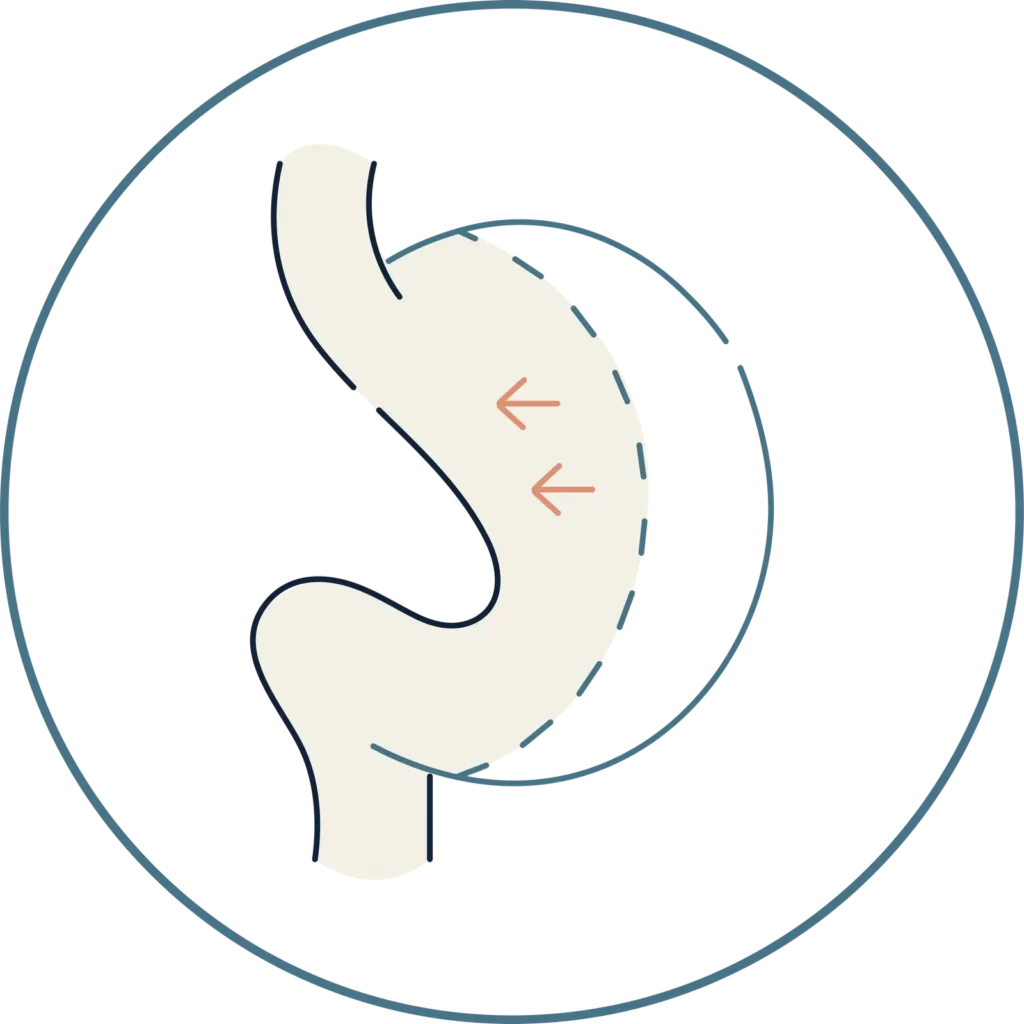 Como bajar de peso rápido-Glbal Obesity Group- Acompañamiento en Bogotá