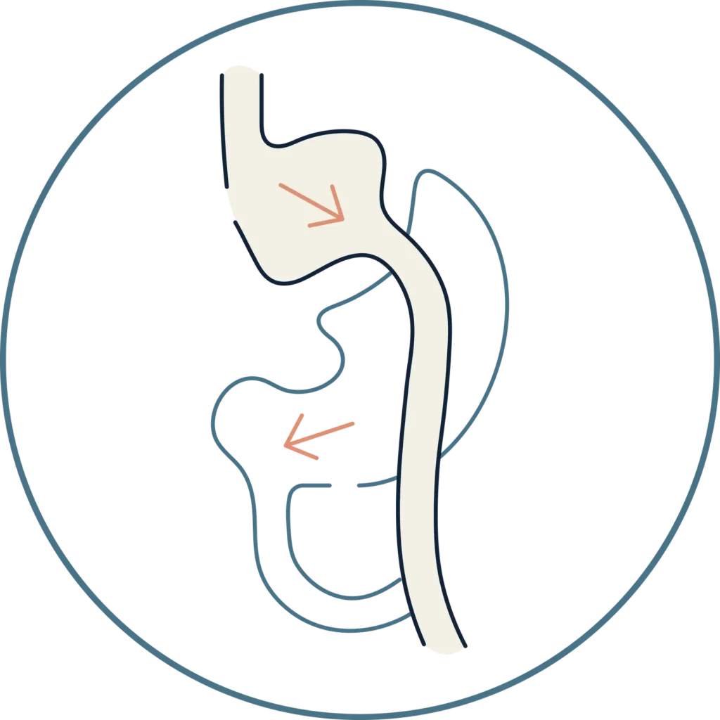 Como bajar de peso rápido-Glbal Obesity Group- Acompañamiento en Bogotá