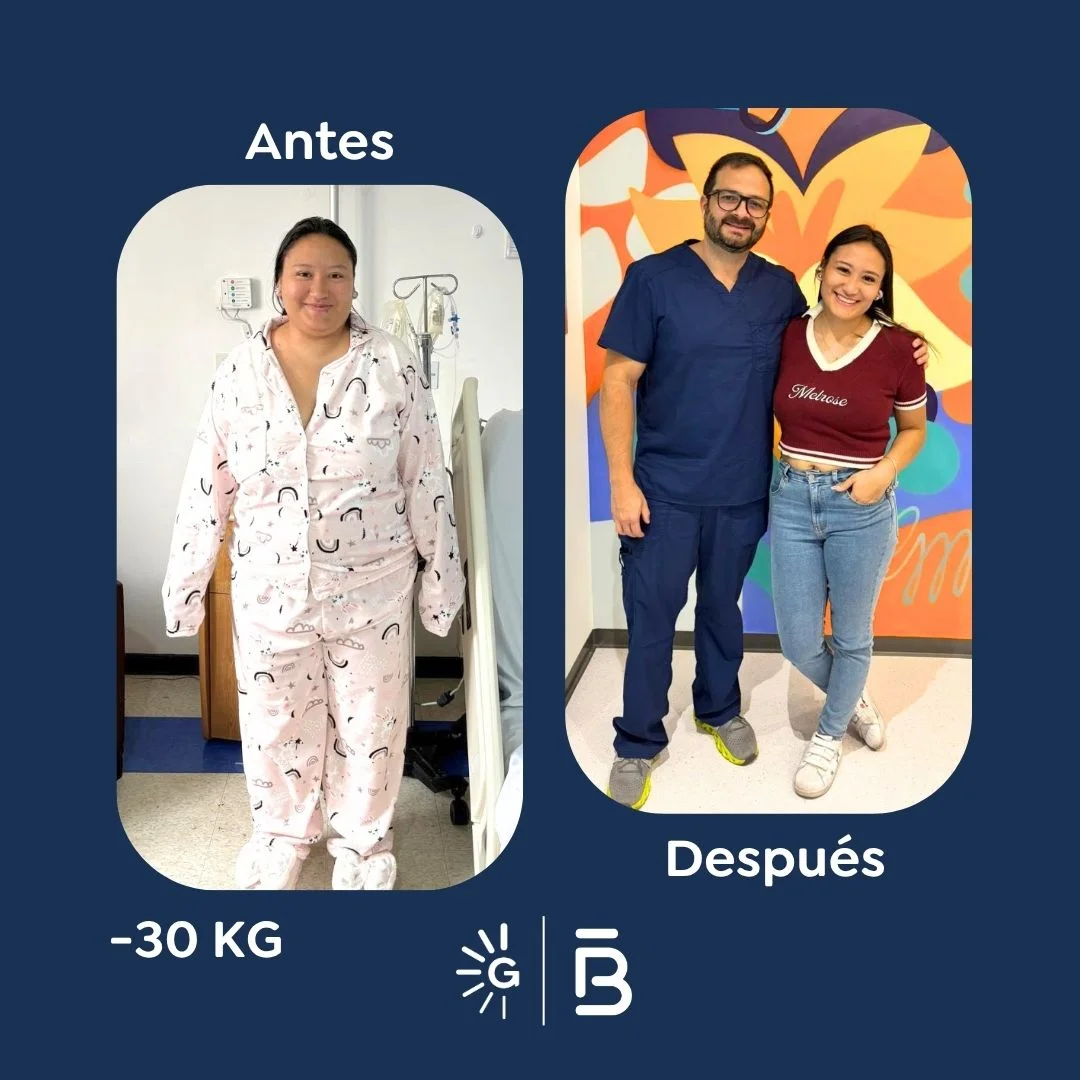 Antes y después de la Cirugía Bariátrica con el Dr. Felipe Bernal en Global Obesity Group -