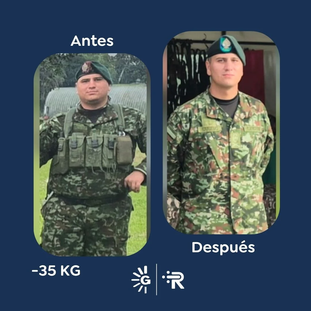 Antes y después de la Cirugía Bariátrica con el Dr. Rubén Luna en Global Obesity Group
