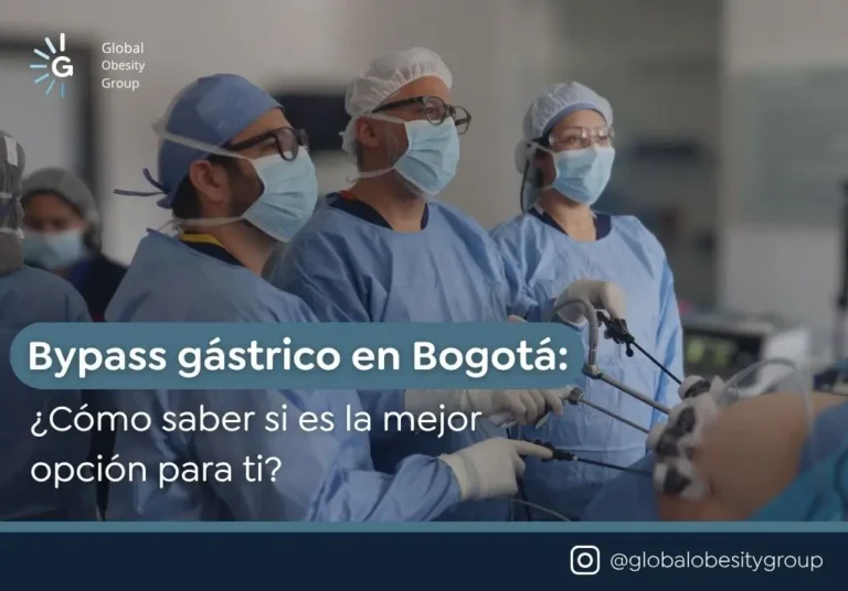Bypass gástrico en Bogotá Cómo saber si es la mejor opción para ti - Global obesity group (2)