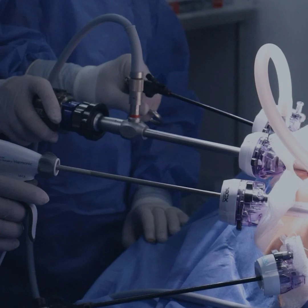 Laparoscopic minimally invasive bariatric surgery at Global Obesity Group in Colombia
