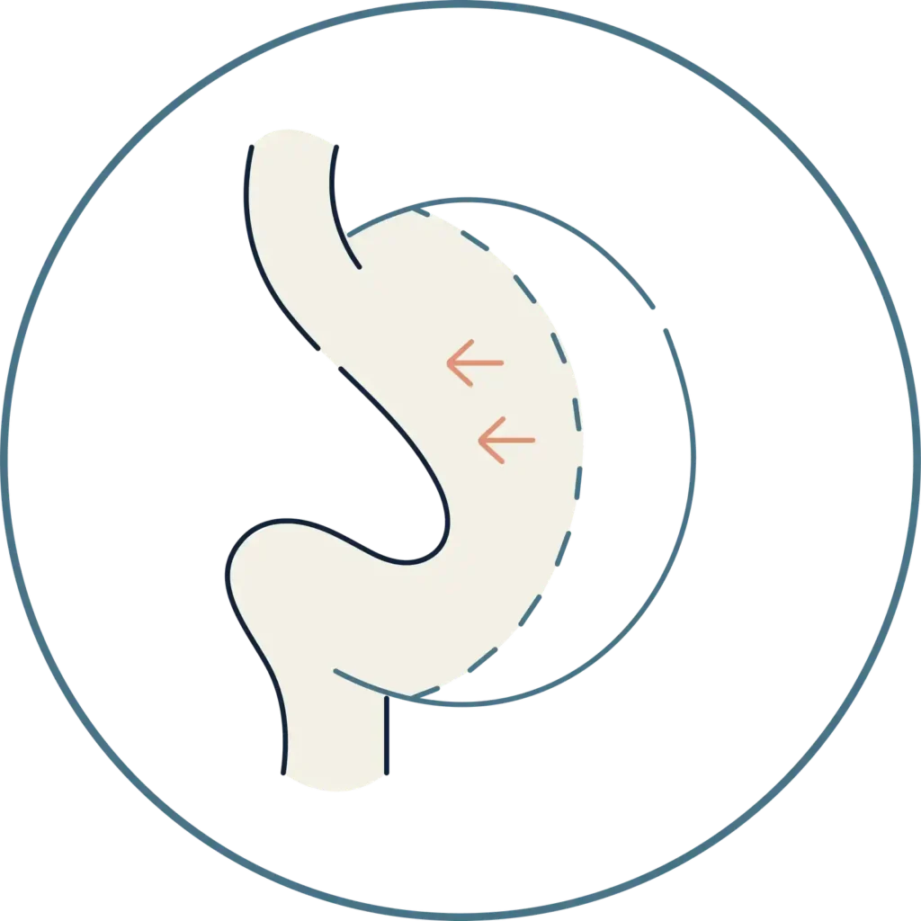 for how to weigh loss fast- Global Obesity Group