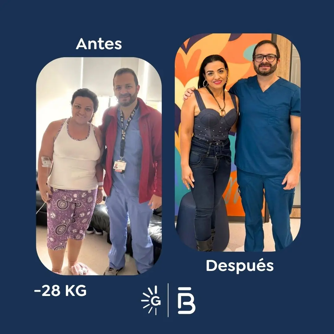Cirugía bariátrica antes y después en Bogotá, Colombia - Global Obesity Group - Dr. Felipe Bernal - Manga gástrica - Bypass gástrico 03082026