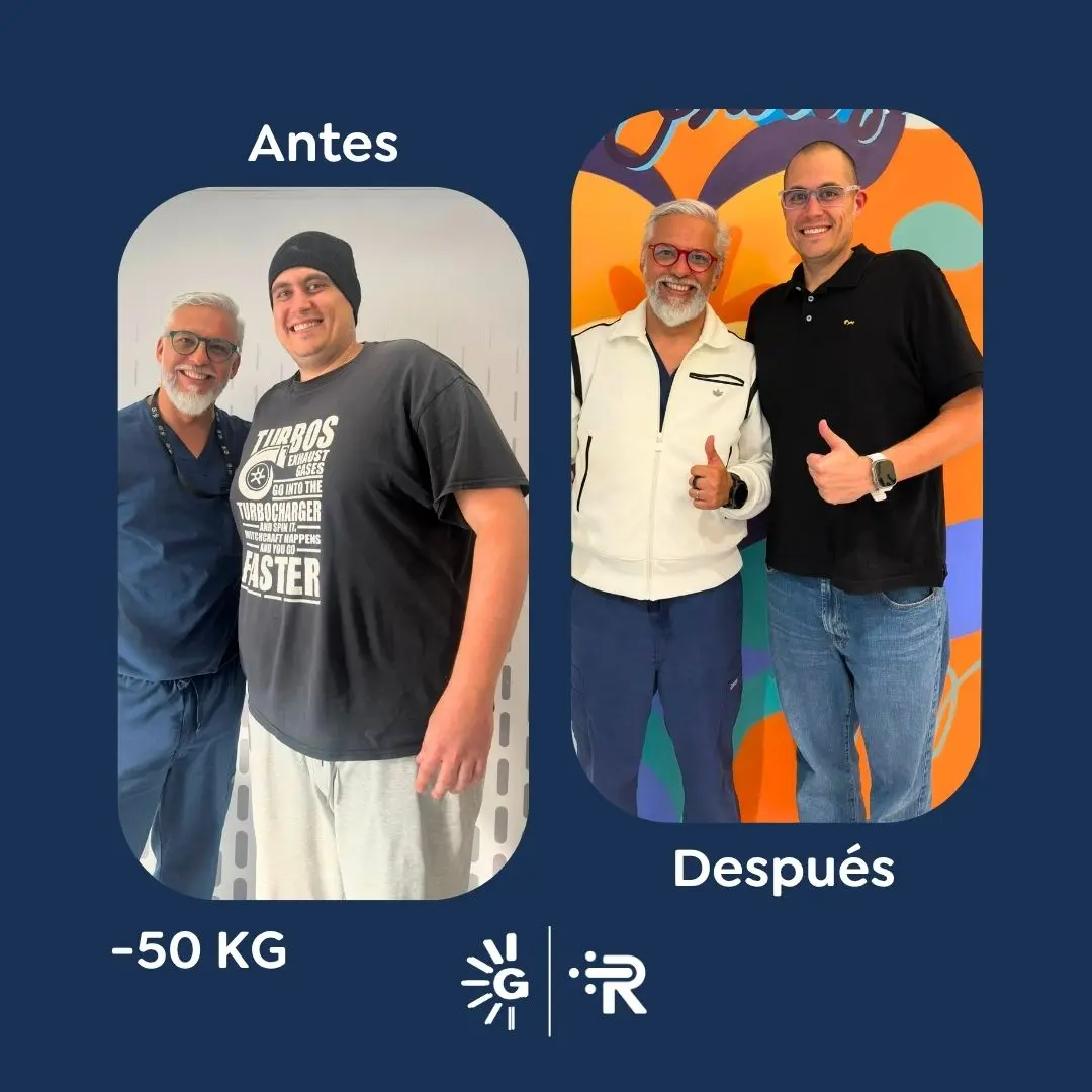 Cirugía bariátrica antes y después en Bogotá, Colombia - Global Obesity Group - Dr. Rubén Luna - Manga gástrica - Bypass gástrico 03082026 1