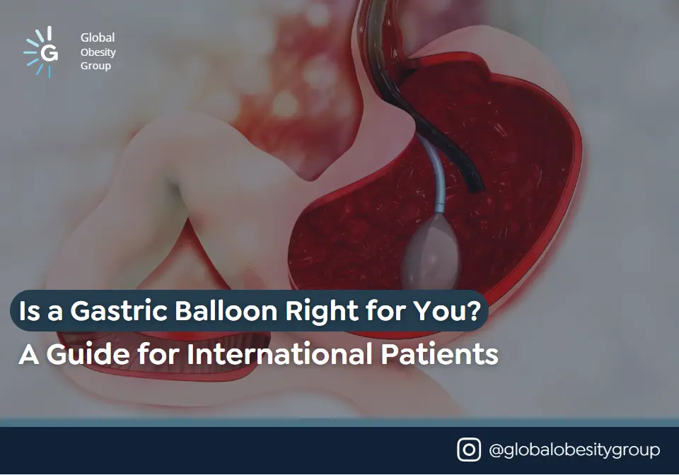 Gastric Balloon In Colombia- Global Obesity Group