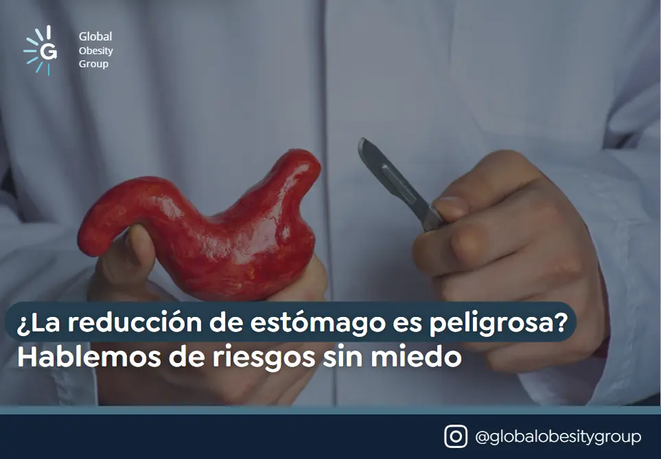 La reducción de estómago es peligrosa- Global Obesity Group en Bogotá