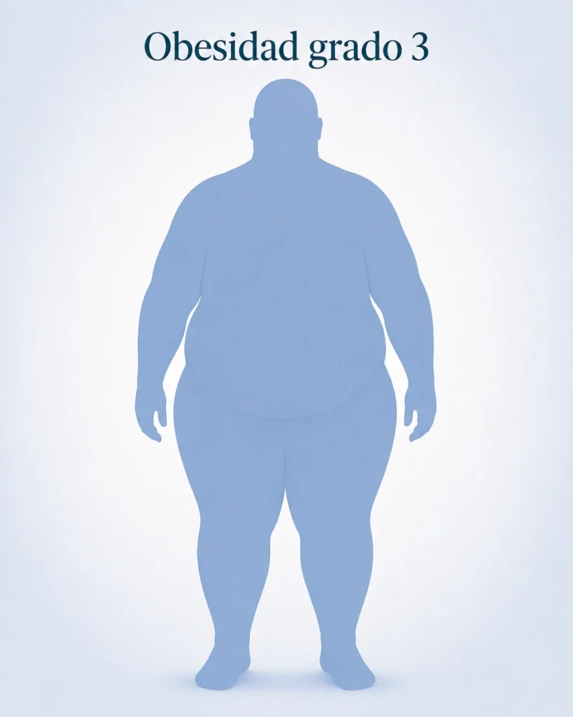 Tipos de obesidad - Obesidad grado 3 - Global Obesity Group