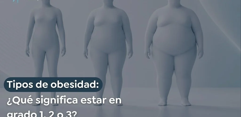 Tipos de obesidad Qué significa estar en grado 1, 2 o 3 - Global obesity group