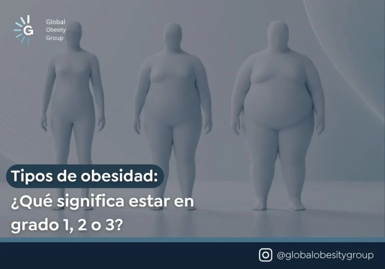 Tipos de obesidad Qué significa estar en grado 1, 2 o 3 - Global obesity group