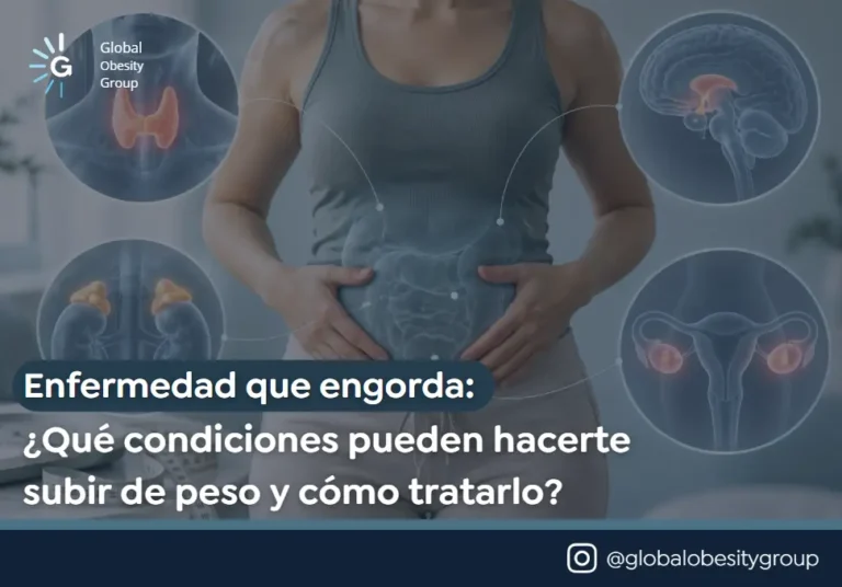 Enfermedad que engorda- Global Obesity Group en Bogotá