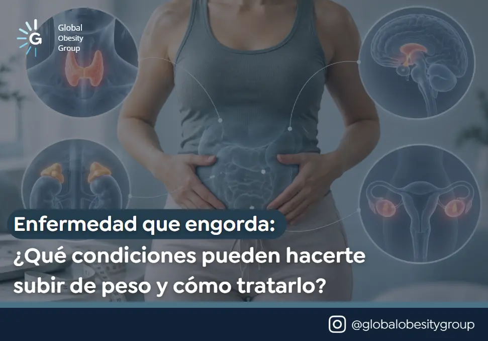 Enfermedad que engorda- Global Obesity Group en Bogotá