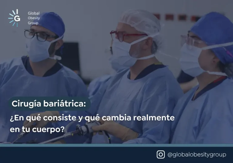 En que consiste la cirugia bariatrica - Global Obesity Group - Bogotá, Colombia